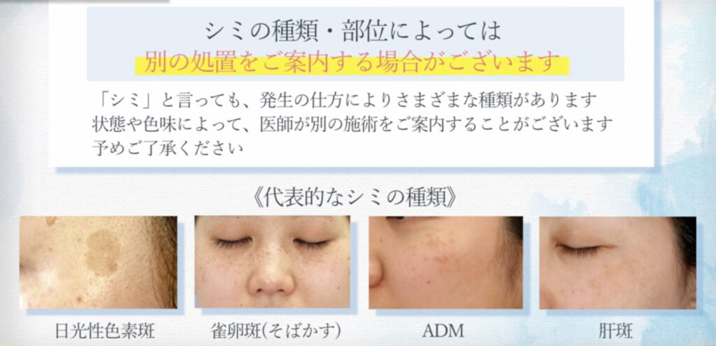 湘南美容クリニックのシミ取りレーザー10(26,000円)の注意事項