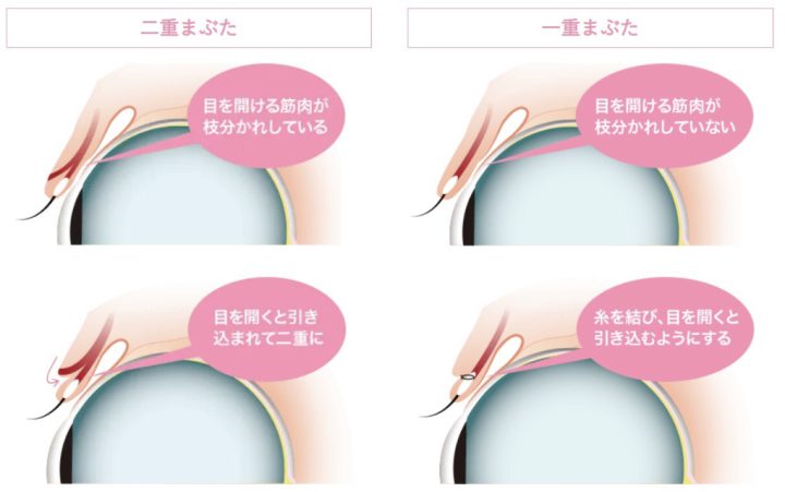 湘南美容クリニック 二重整形