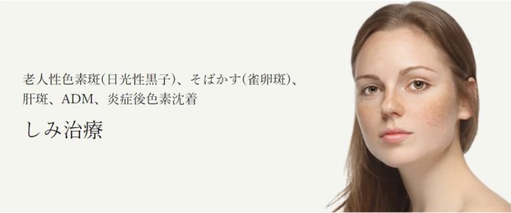 共立美容外科仙台院 シミ取り放題