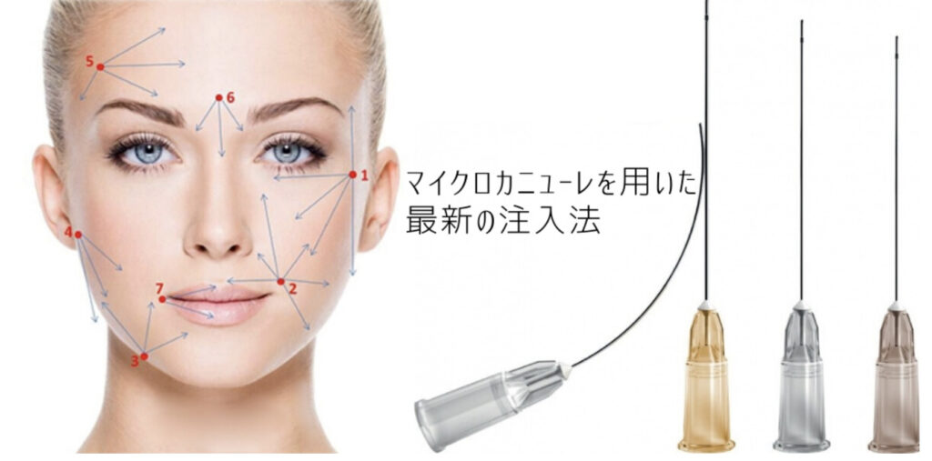 Nビューティ銀座 ヒアルロン酸