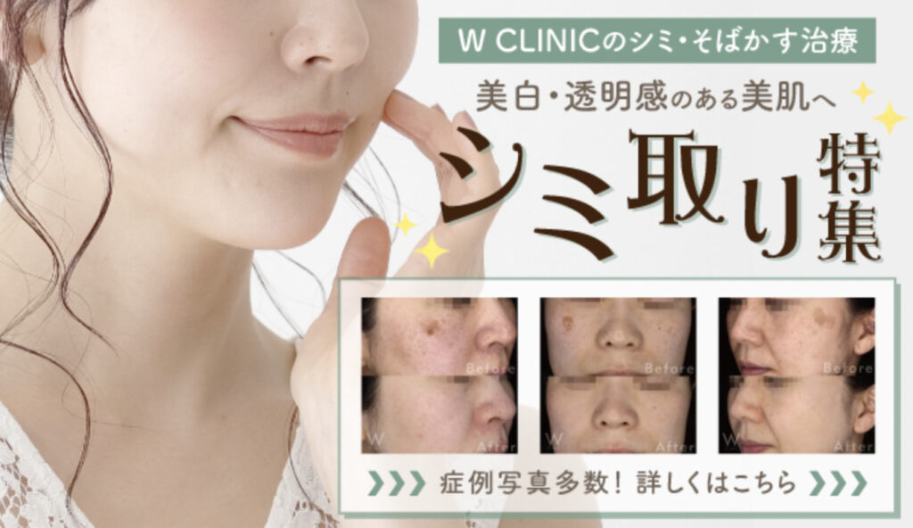 Wクリニック 心斎橋院 ピコスポットシミ取り