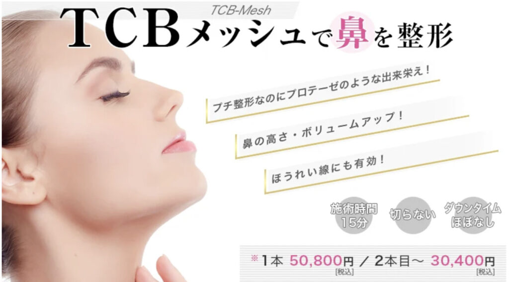 TCBメッシュ 口コミ