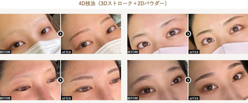 湘南美容クリニック アートメイク(4D技法) 症例画像