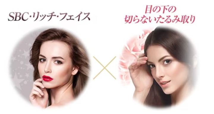 湘南美容クリニック 目の下の切らないたるみ取り