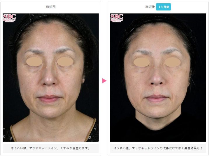 湘南美容クリニック プロファイロ