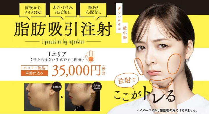 輪郭整形 切らない