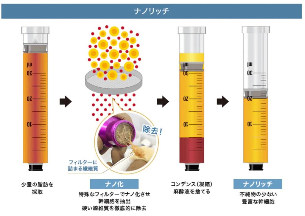湘南美容クリニック ナノリッチ