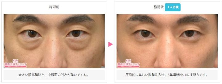 湘南美容クリニック ナノリッチ