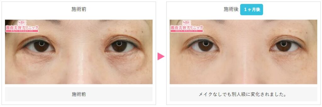 湘南美容クリニック ナノリッチ