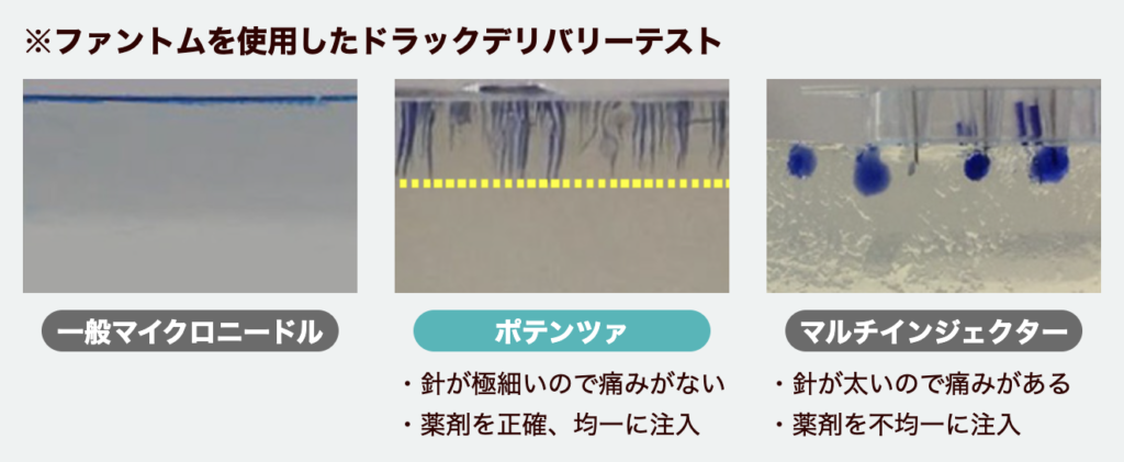 ポテンツァ 口コミ