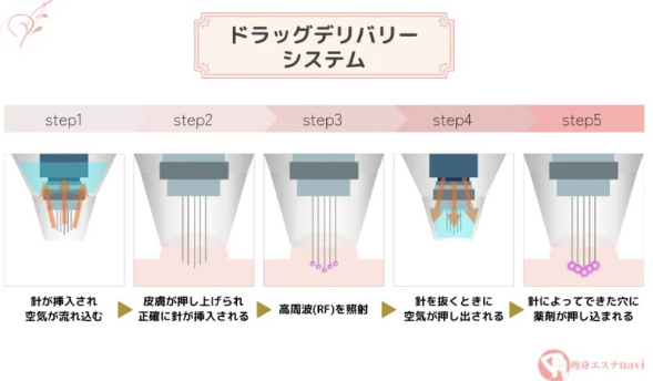 ポテンツァドラッグデリバリーシステム　オリジナル画像