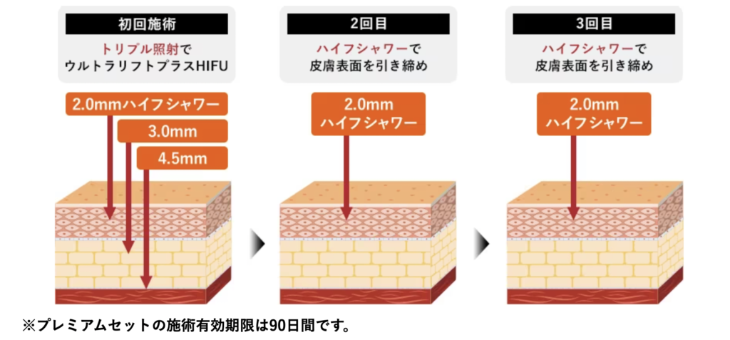 ハイフシャワー 効果