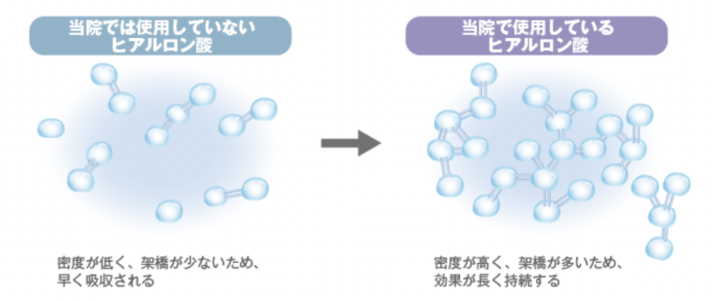 高須クリニック ヒアルロン酸