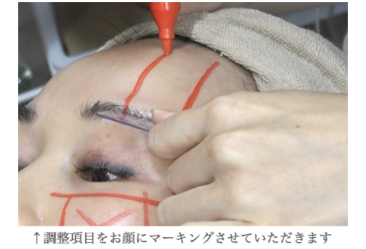 ハイフシャワー 効果