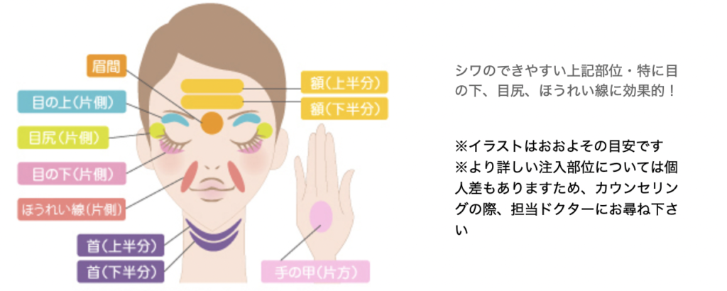 ほうれい線治療 おすすめ
