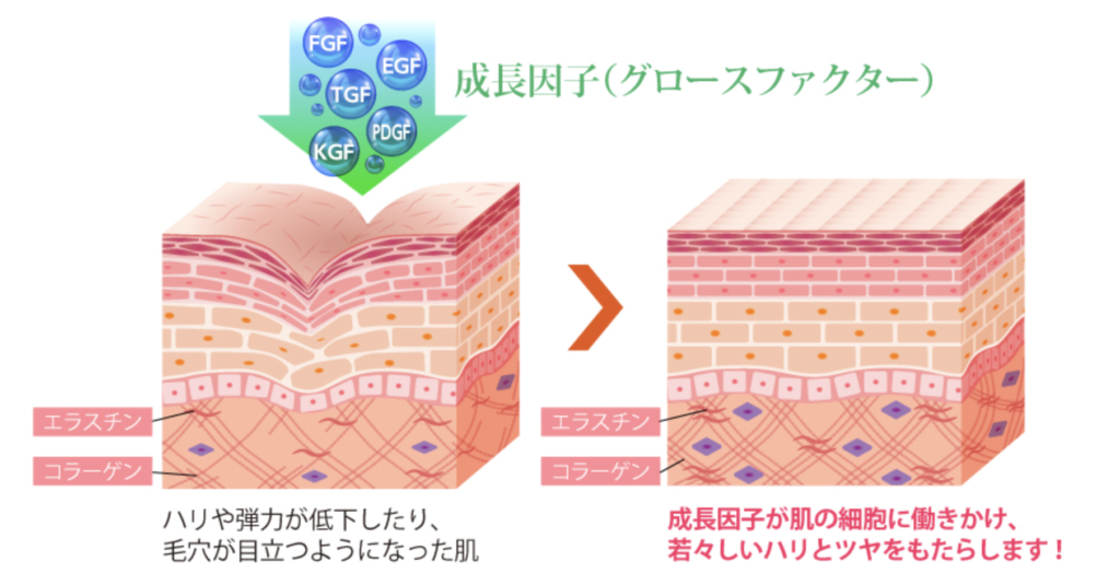 ほうれい線治療 おすすめ
