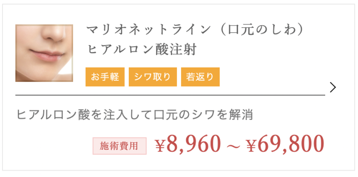 TCB東京中央美容外科 東京　ヒアルロン酸
