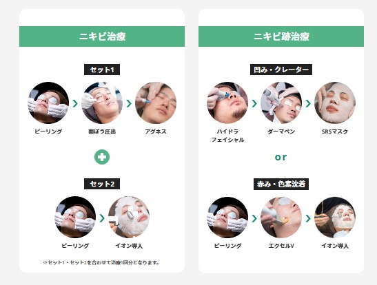 ゴリラクリニック 名古屋 ニキビセットプラン