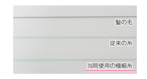 聖心美容クリニック 二重埋没法 糸