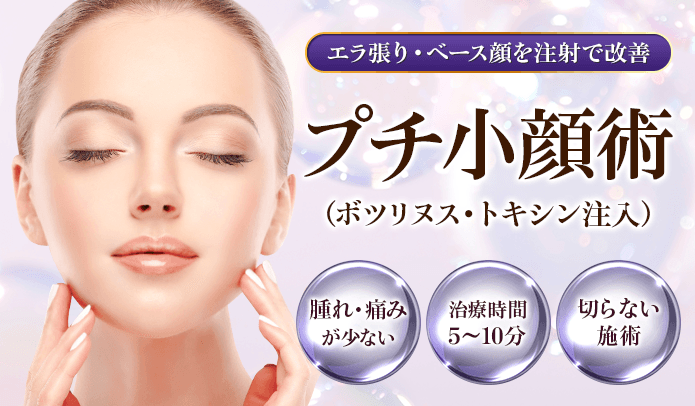 表情ボトックス