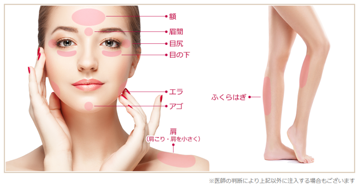 品川美容外科　エラボトックス