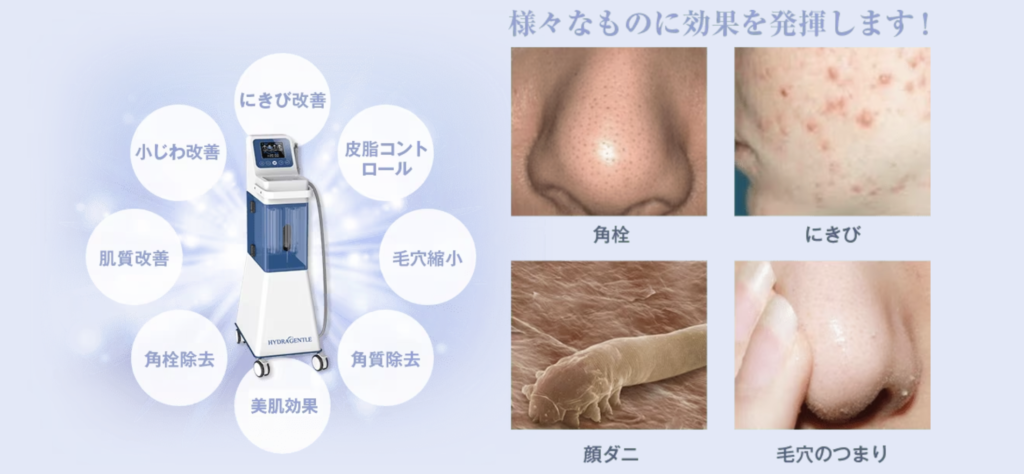 ハイドラジェントル 効果(ハイドラフェイシャルとの違い)