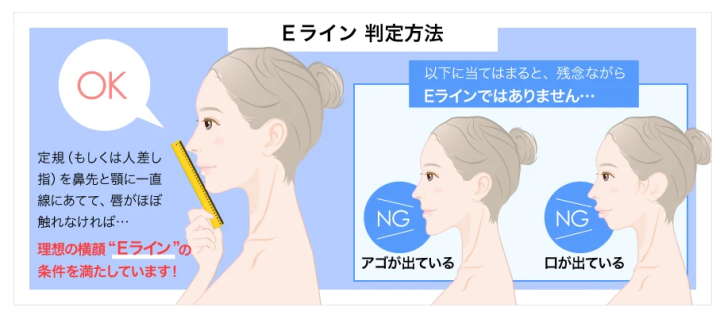 TCB東京中央美容外科 顎ボトックス