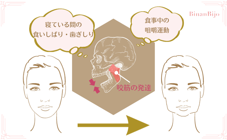 食いしばり　歯ぎしり