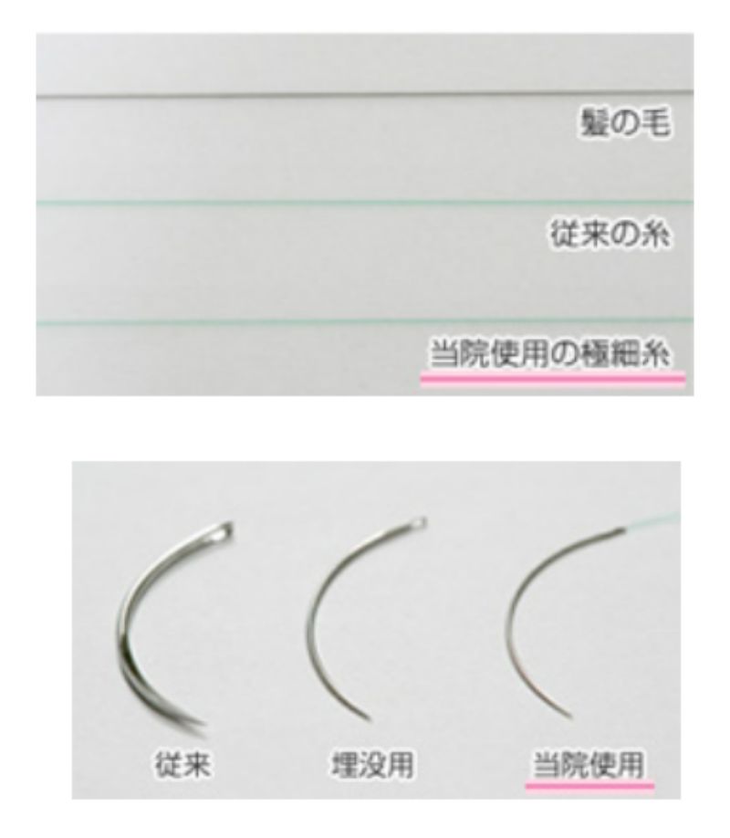 聖心美容クリニック 埋没法 器具 札幌