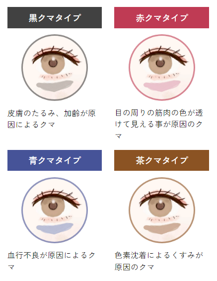 NALU Beauty Clinic　目の下のクマ取り