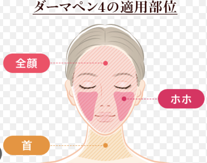 ダーマペン 適用範囲 品川美容外科