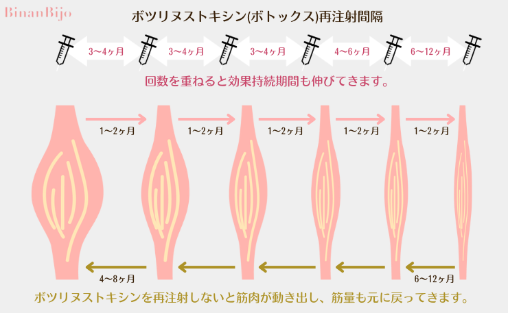 エラボトックス　持続期間