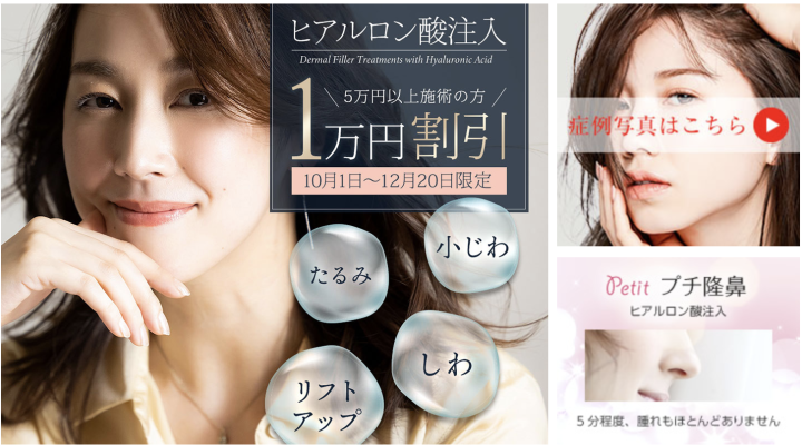 城本クリニック ヒアルロン酸
