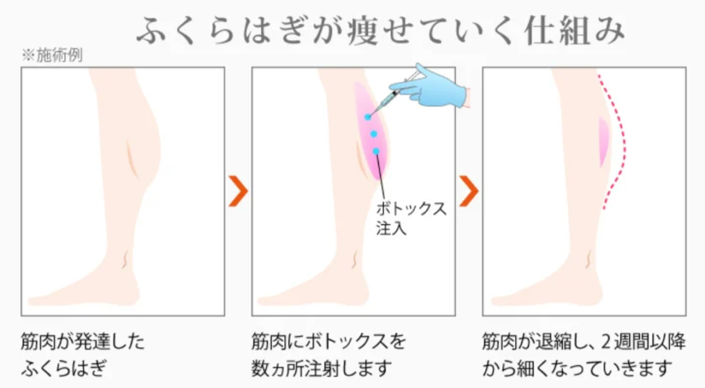 TCB東京中央美容外科