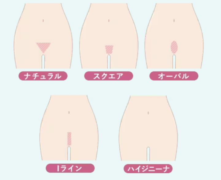 湘南美容クリニック 名古屋 VIO脱毛
