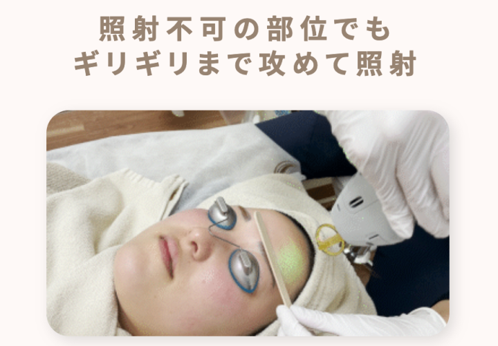 ルシアクリニック 医療脱毛 口コミ
