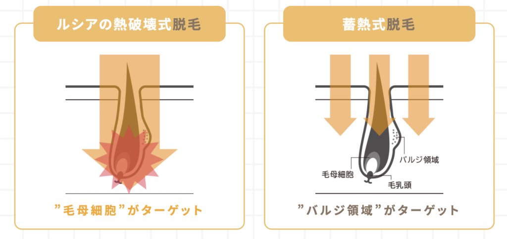 ルシアクリニック 名古屋 VIO脱毛