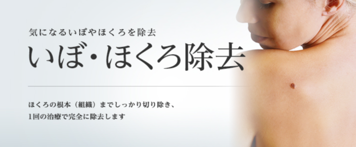 東京美容外科いぼ・ほくろ除去