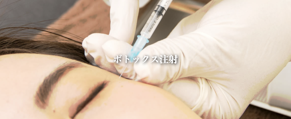 ミルディス皮フ科 横浜院 エラボトックス