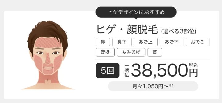 メンズエミナル_脱毛