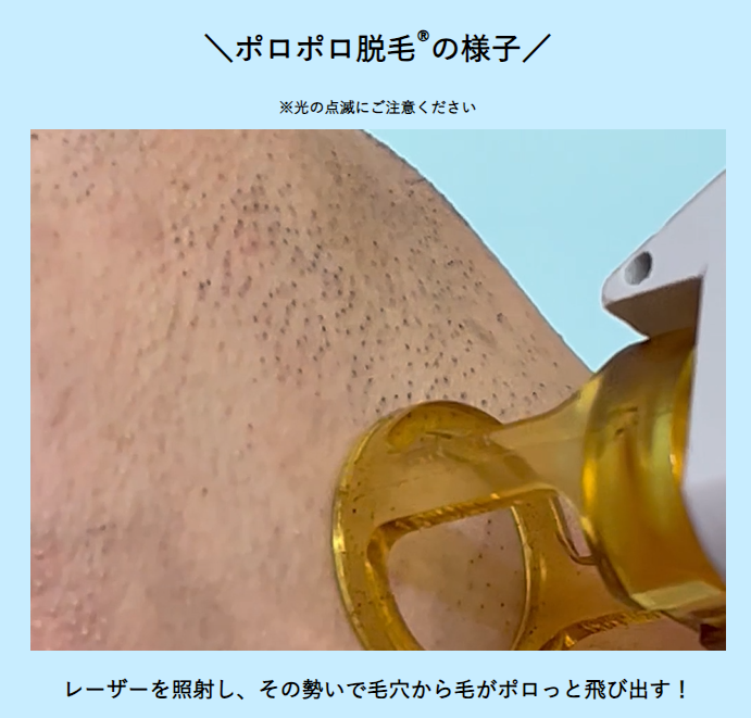 湘南美容クリニックMEN'SのVIO脱毛