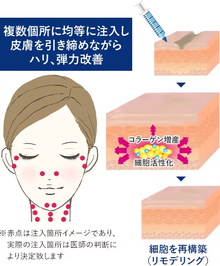 プロファイロ_施術解説