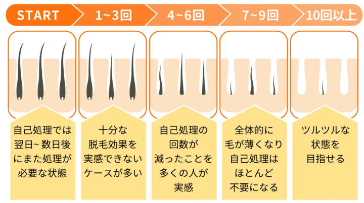 脱毛回数