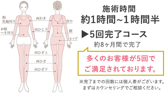 ウィルビークリニック 全身脱毛