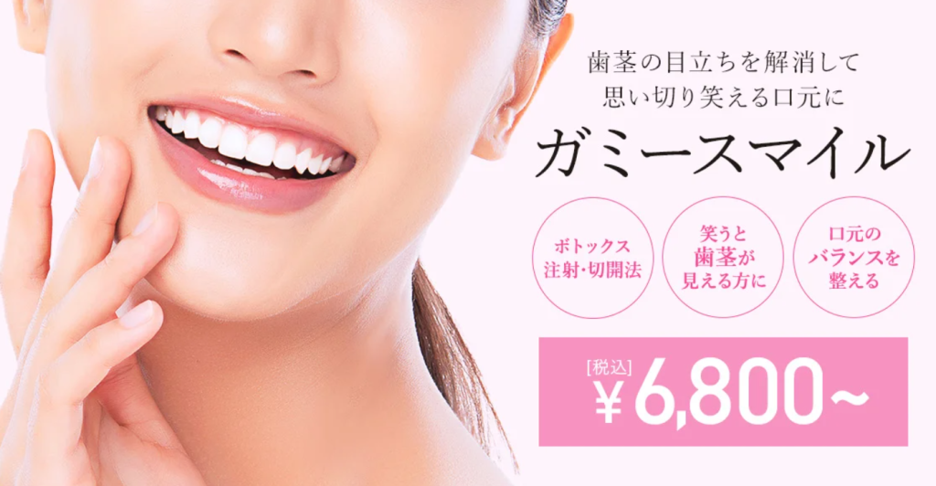 TCB東京中央美容外科　ガミースマイル