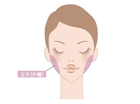 品川美容外科　エラボトックス