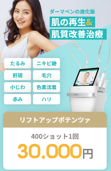 リゼポテンツァ