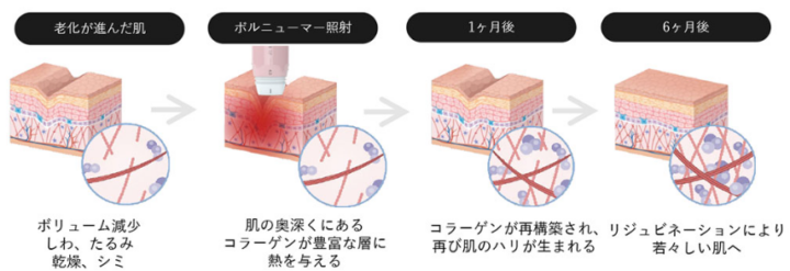 なとり皮膚科くまのどう内科下肢静脈瘤クリニック ボルニューマ
