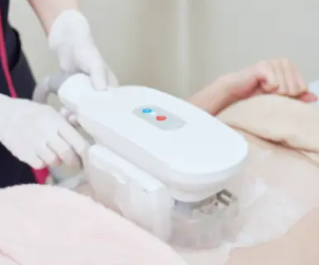エミナルクリニック 脂肪冷却