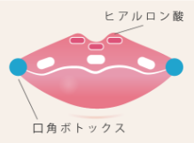ルラ美容クリニック Cカールリップ
